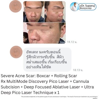 Testimonials รีวิวผลการรักษา ความประทับใจจากคนไข้ ที่มาใช้บริการที่  DeMed Clinic