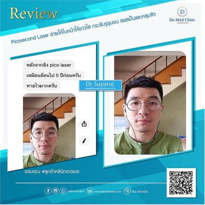 Review ผลการรักษาด้วยโปรแกรม Picosecond Laser  และโปรแกรมต่างๆ และ ผู้ใช้บริการที่ DeMed Clinic