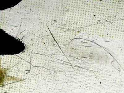 SN35156