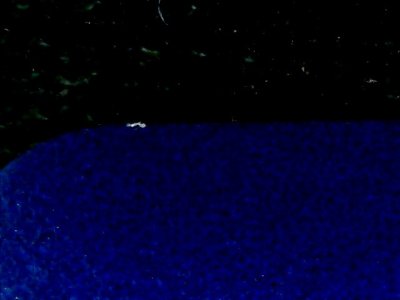 SN35560