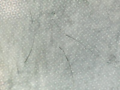 SN35867