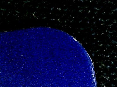 SN35911