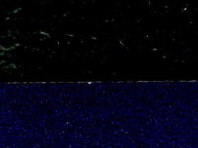 SN36161