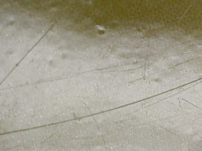 SN36797
