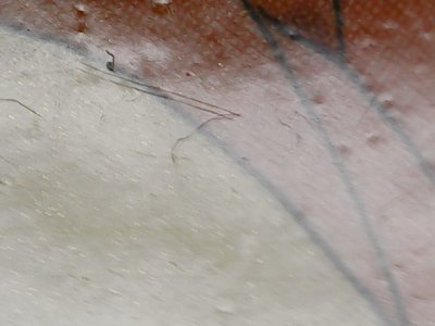 SN36797