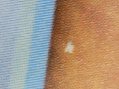SN36797