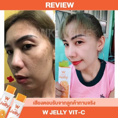  Review ผู้รับประทานจริง (WINK WHITE JELLY VIT-C วิ้งค์ไวท์ เจลลี่ วิตซี)