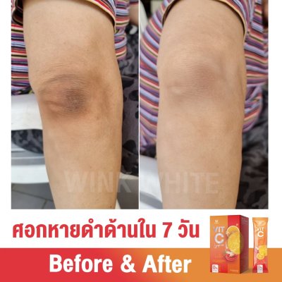  Review ผู้รับประทานจริง (WINK WHITE VIT-C LYCOPENE วิงค์ไวท์ วิตซี ไลโคปีน)