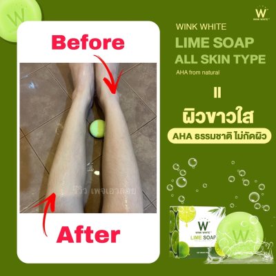  Review ผู้ใช้จริง (WINK WHITE LIME SOAP)