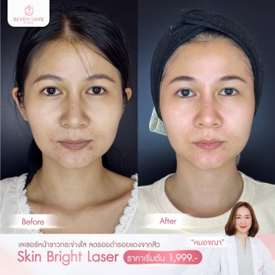 รีวิว Skin Bright