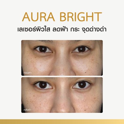 Review Aura Bright