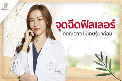 จุดฉีดฟิลเลอร์ที่คุณไม่อาจ ไม่เคยรู้มาก่อน