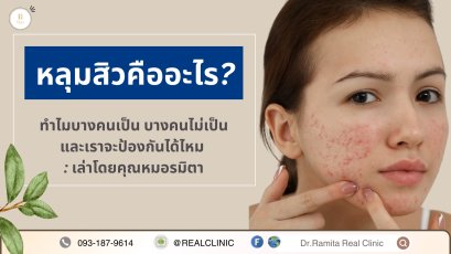 หลุมสิวคืออะไร? หลุมสิวเกิดขึ้นได้อย่างไร ทำไมบางคนเป็น บางคนไม่เป็น และเราจะป้องกันได้ไหม : เล่าโดยคุณหมอรมิตา