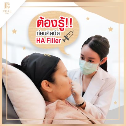 ฟิลเลอร์คืออะไร ฉีดฟิลเลอร์ แล้วช่วยอะไร ?