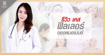รีวิวฟิลเลอร์ หมอเบนซ์ RealClinic ฟิลเลอร์ใต้ตา ฟิลเลอร์คาง ฟิลเลอร์ร่องแก้ม ฟิลเลอร์ขมับ