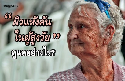 ผิวแห้งคันในผู้สูงวัยดูแลอย่างไร?