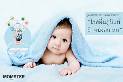 “ดูแลผิวบอบบางแพ้ง่ายของเด็กอย่างไร ให้ห่างไกลจากโรคผื่นภูมิแพ้ผิวหนังอักเสบ”