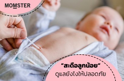“สะดือลูกน้อย” ดูแลยังไงให้ปลอดภัย