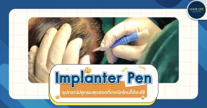 Implanter Pen อุปกรณ์ปลูกผมสุดฮอตที่เทคนิคไหนก็ต้องใช้