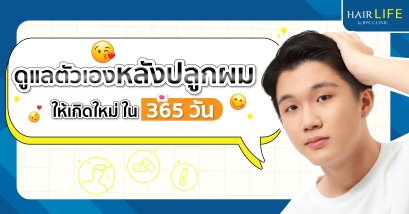 ดูแลตัวเองหลังปลูกผม ให้เกิดใหม่ ใน 365 วัน