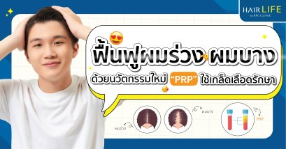 ฟื้นฟูผมร่วง ผมบาง ด้วยนวัตกรรมใหม่ “PRP” ใช้เกล็ดเลือดรักษา