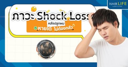 ภาวะ Shock Loss หลังปลูกผม หายได้ ไม่ต้องกลัว