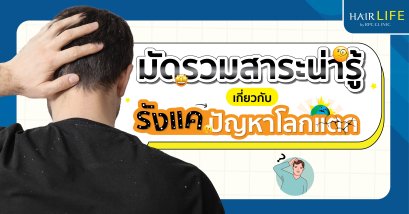 มัดรวมสาระน่ารู้เกี่ยวกับรังแค ปัญหาโลกแตก ! 