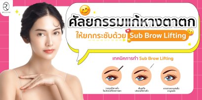 ศัลยกรรมแก้หางตาตก ให้ยกกระชับ ด้วย Sub Brow Lifting  