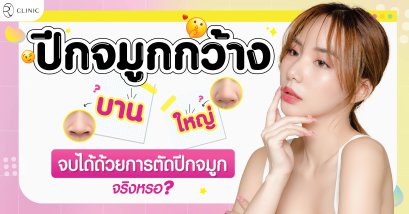 ปีกจมูกกว้าง บาน และใหญ่ จบได้ด้วยการตัดปีกจมูก จริงหรอ?