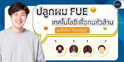 ปลูกผม FUE เทคโนโลยีเพื่อคนหัวล้าน  ผมขึ้นใหม่ ไร้รอยแผล
