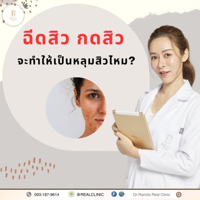 รักษาสิวอย่างไรดีที่สุด การฉีดสิว กดสิว ทำให้กลายเป็นหลุมสิวหรือไม่ ทำให้สิวหายไวขึ้นไหม