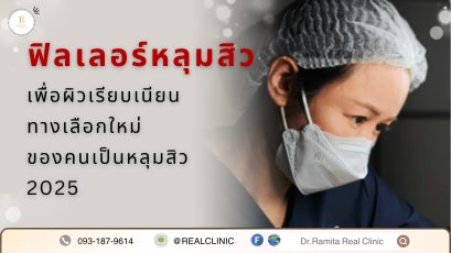 รักษาหลุมสิว,ตัดพังผืด,รักษาหลุมสิว, วิธีรักษาหลุมสิว, Subcision, เติมฟิลเลอร์, Real Scar Synergy, รักษาหลุมสิวที่ไหนดี,Juvgen,acnescarsurgery,acnescarrevision,รักษาหลุมสิวให้ตื้น,เลเซอร์หลุมสิว, รักษาหลุมสิวที่ดีที่สุด,รักษาหลุมสิวให้หายขาด,หลุมสิว,realc