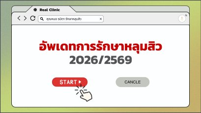 อัพเดทการรักษาหลุมสิว 2569/2026 เน้นเห็นผลชัด พักฟื้นน้อย ผลลัพธ์ยั่งยืนสู่การฟื้นฟูผิว ด้วยแนวคิด Regenerative Procedural