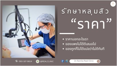 รักษาหลุมสิวราคา