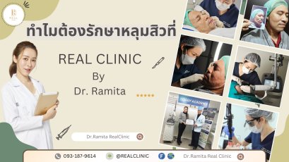 "รักษาหลุมสิว" ที่ Real Clinic By Dr. Ramita พิเศษอย่างไร 