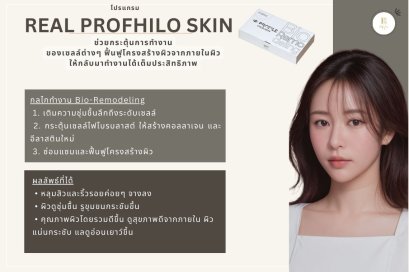 Profhilo รักษาหลุมสิวได้จริงหรือ? เจาะกลไกและผลลัพธ์การทำงานของ Profhilo
