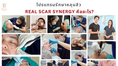 Program Real Scar Synergy กับ Dr.Ramita  คืออะไร? รักษาหลุมสิว ฟื้นฟูหลุมสิว ตัดพังผืด