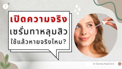 ครีม เซรั่มทารักษาหลุมสิว ช่วยได้จริงหรือหลอก? วันนี้หมอจะพาไปเปิดเผยความจริงกันค่ะ