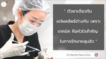 ฉีดมาแล้วไม่เห็นผล? หมออธิบายชัด! ทำไม ฉีดฟื้นฟูหลุมสิว ถึงต่างจากการฉีดบำรุงทั่วไป