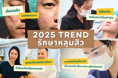 "อัปเดตเทรนด์ รักษาหลุมสิว ปี2025/2568" เห็นผลชัด พักฟื้นน้อย ไม่ต้องทำบ่อย ใช้ชีวิตง่าย ผลลัพธ์ยาวนาน