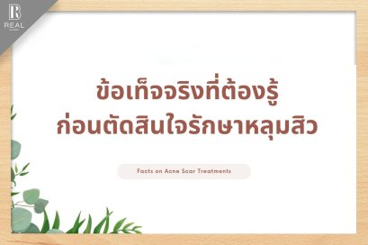 ต้องรู้!! ก่อนตัดสินใจรักษาหลุมสิว กับ Dr. Ramita