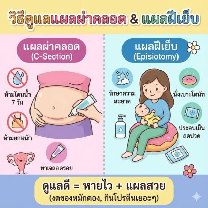 วิธีดูแลแผลผ่าคลอด & แผลฝีเย็บ ให้หายเร็ว ไม่เป็นคีย์ลอยด์ (อัปเดต 2025)