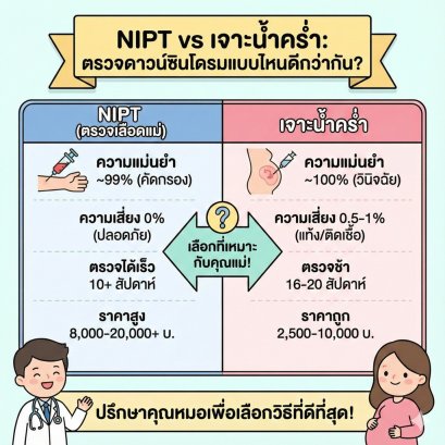 NIPT vs เจาะน้ำคร่ำ ตรวจดาวน์ซินโดรมแบบไหนดีกว่ากัน? เจาะลึกข้อดี-ข้อเสีย เพื่อลูกน้อยในครรภ์