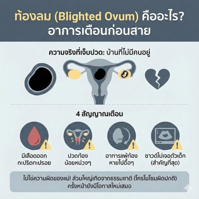 ท้องลม (Blighted Ovum) คืออะไร? อาการเตือนที่แม่ต้องรู้ก่อนสาย (เช็กก่อนเสียใจภายหลัง)