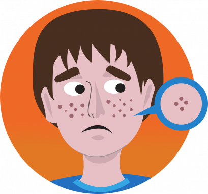 #5เหตุผลทำไมคนเป็นสิวควรทานZinc 