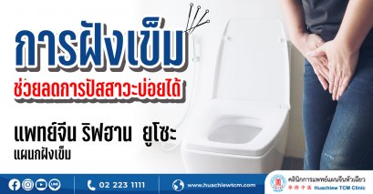 การฝังเข็มช่วยลดการปัสสาวะบ่อยได้