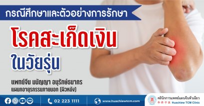 ตัวอย่างการรักษาสะเก็ดเงินในวัยรุ่นด้วยการแพทย์แผนจีน