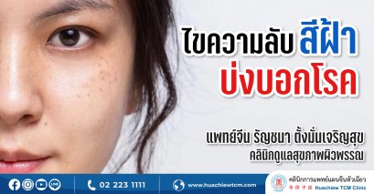 ไขความลับสีฝ้าบ่งบอกโรค ในศาสตร์แพทย์แผนจีน