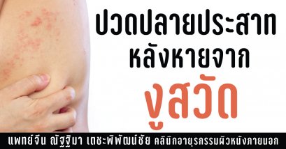 รักษาอาการปวดประสาทจากเชื้องูสวัด