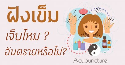 ฝังเข็มเจ็บมากไหม ?  อันตรายหรือไม่ ?